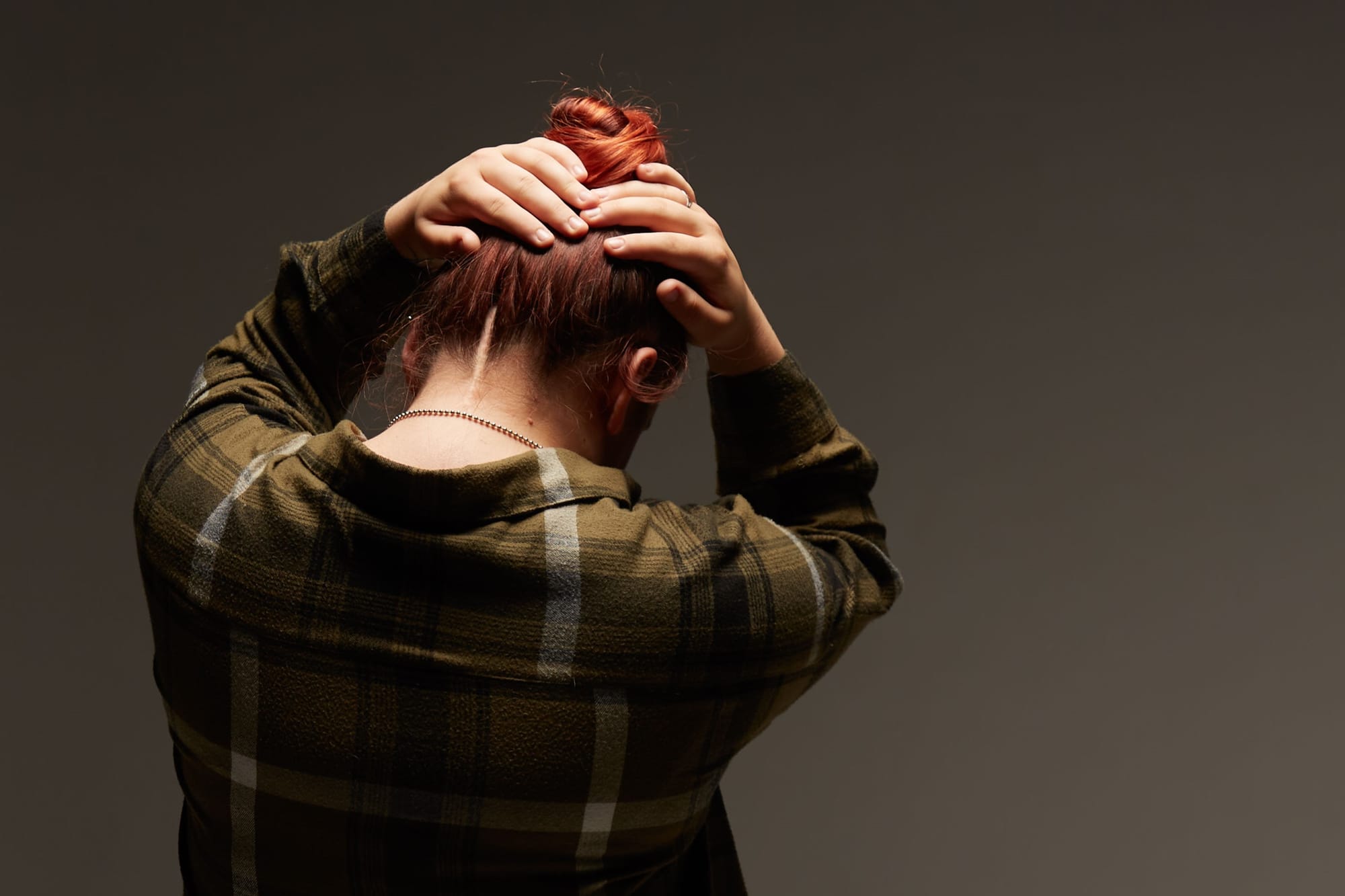 a photo of a woman with her back to the camera, revealing a long scar on the back of her neck